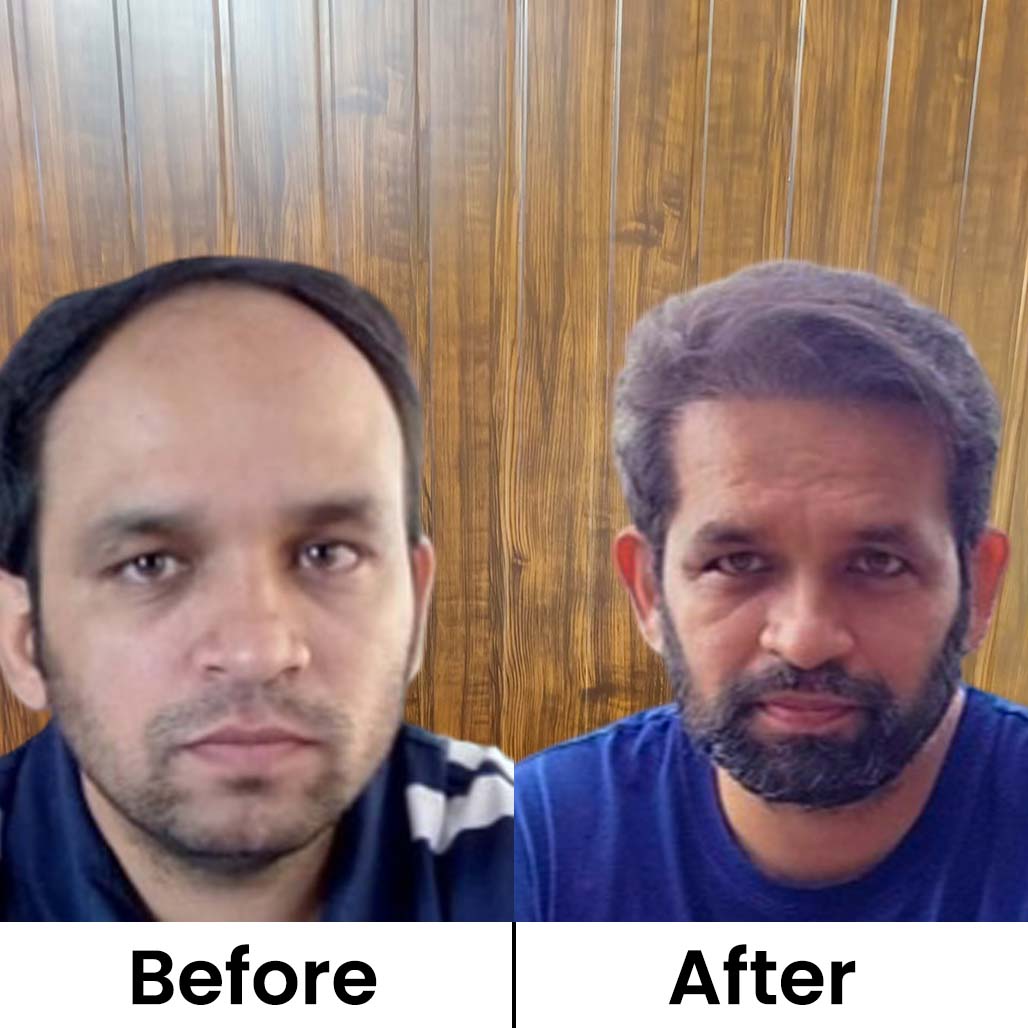 Before After