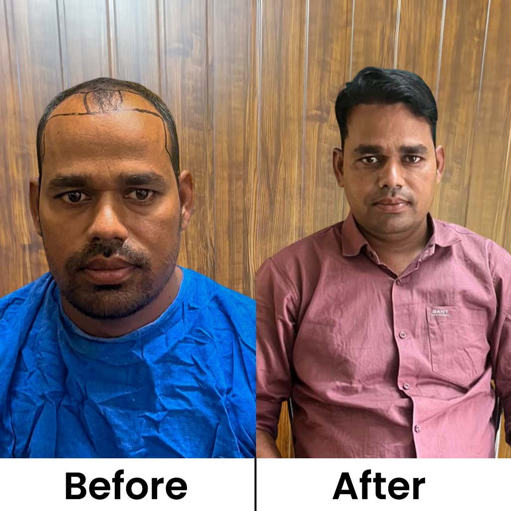 Before After