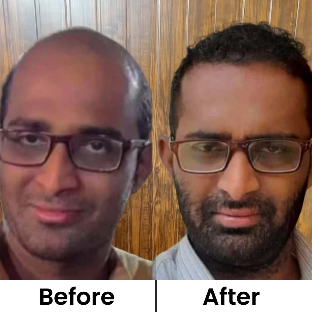 Before After
