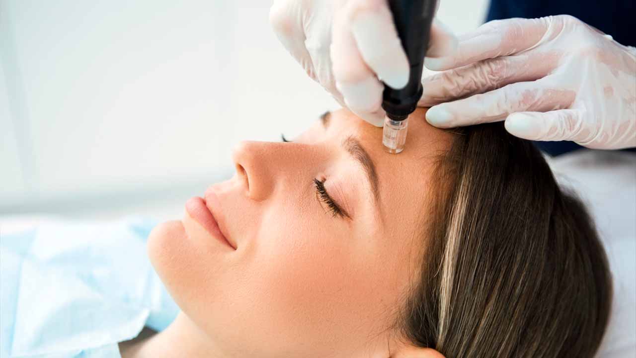 Face PRP Therapy