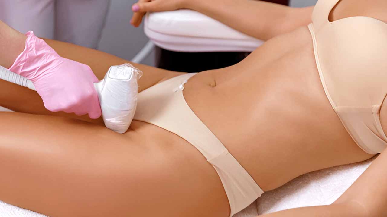 Bikni Laser Hair Reduction