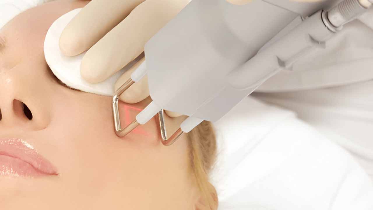 Pigmentation Treatment